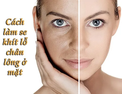 cach20lam20se20khit20lo20chan20long20o20mat cách làm se khít lỗ chân lông ở mặt