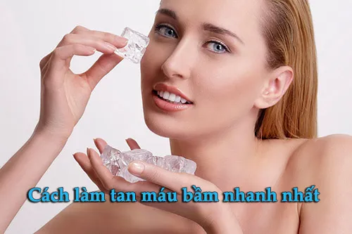 cách làm tan máu bầm nhanh nhất