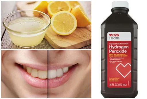 cách làm trắng răng bằng chanh kết hợp oxy già và baking soda