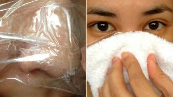 cách nặn mụn đầu đen bước 2