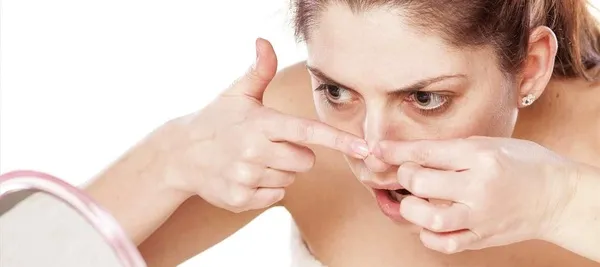 cách nặn mụn đầu đen bước 3