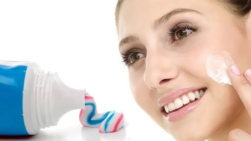cách trị mụn đầu đen tận gốc bằng kem đánh răng