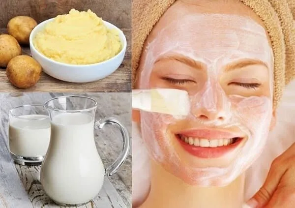cách trị mụn đầu đen tận gốc với khoai tây