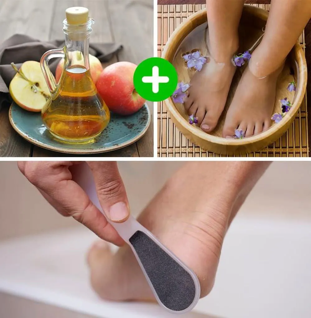 bằng giấm táo