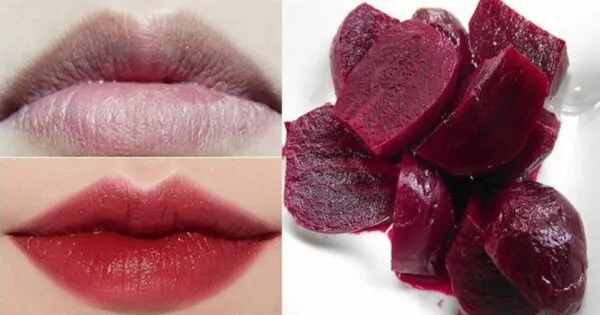 xử lý môi thâm bằng củ dền