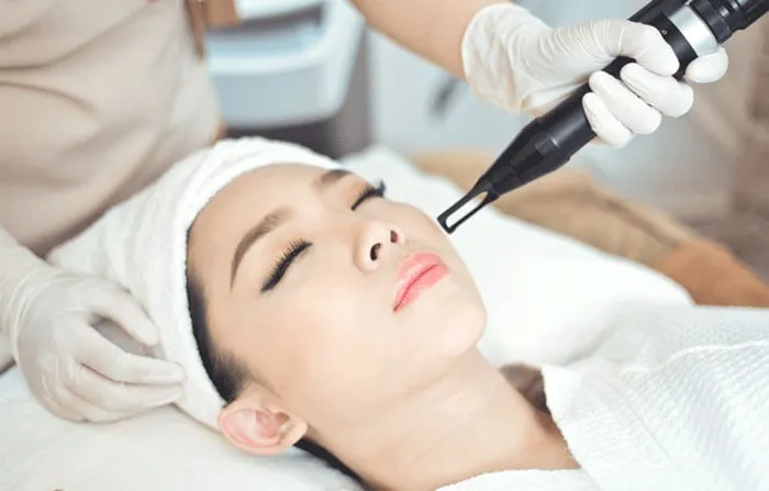 tẩy da thâm bằng tia laser