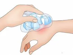 chuom20da20lanh20khi20bi20ong20chich chườm đá viên