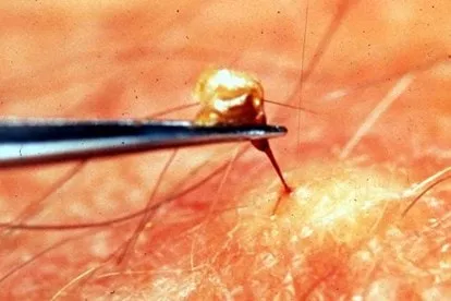 so20cuu20khi20bi20ong20dot sơ cứu nhanh khi bị ong chích